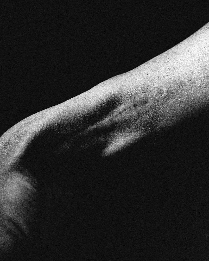 Leg, black and white
