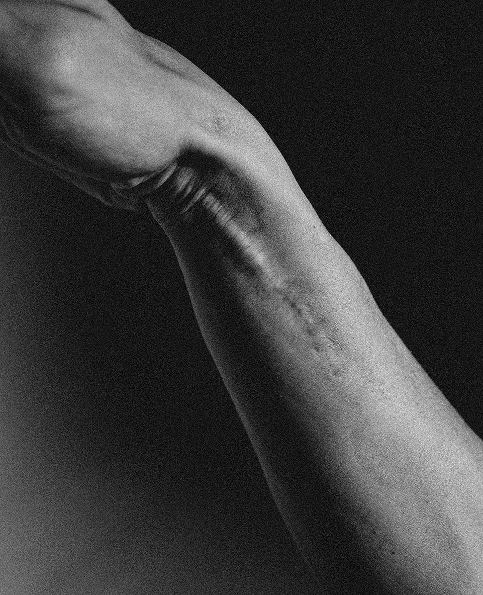 Arm, black and white